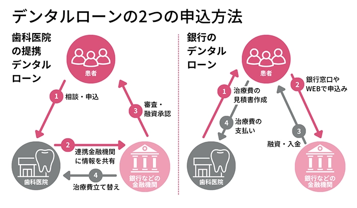 デンタルローンの2つの申込方法